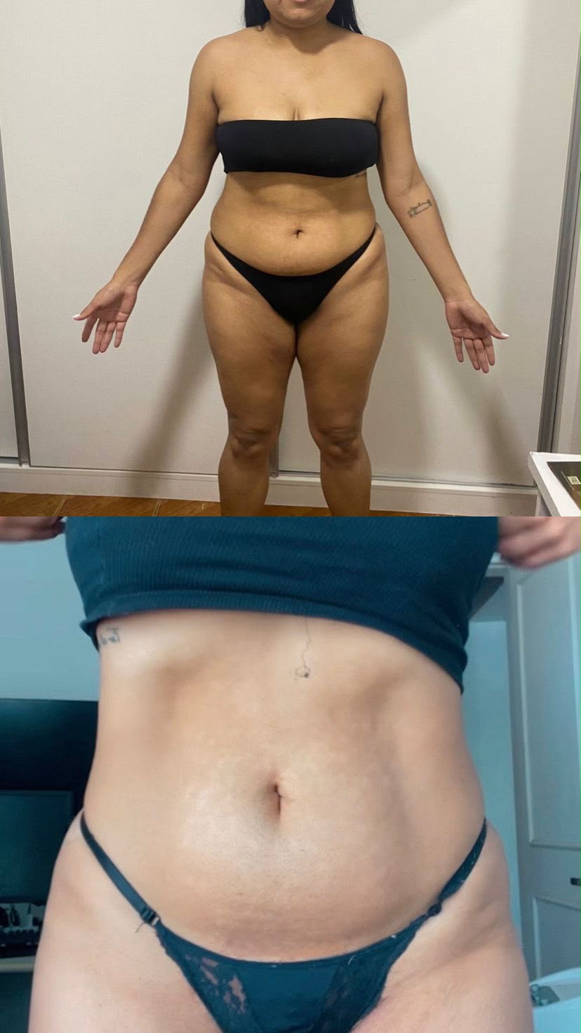 Antes e depois de aluna