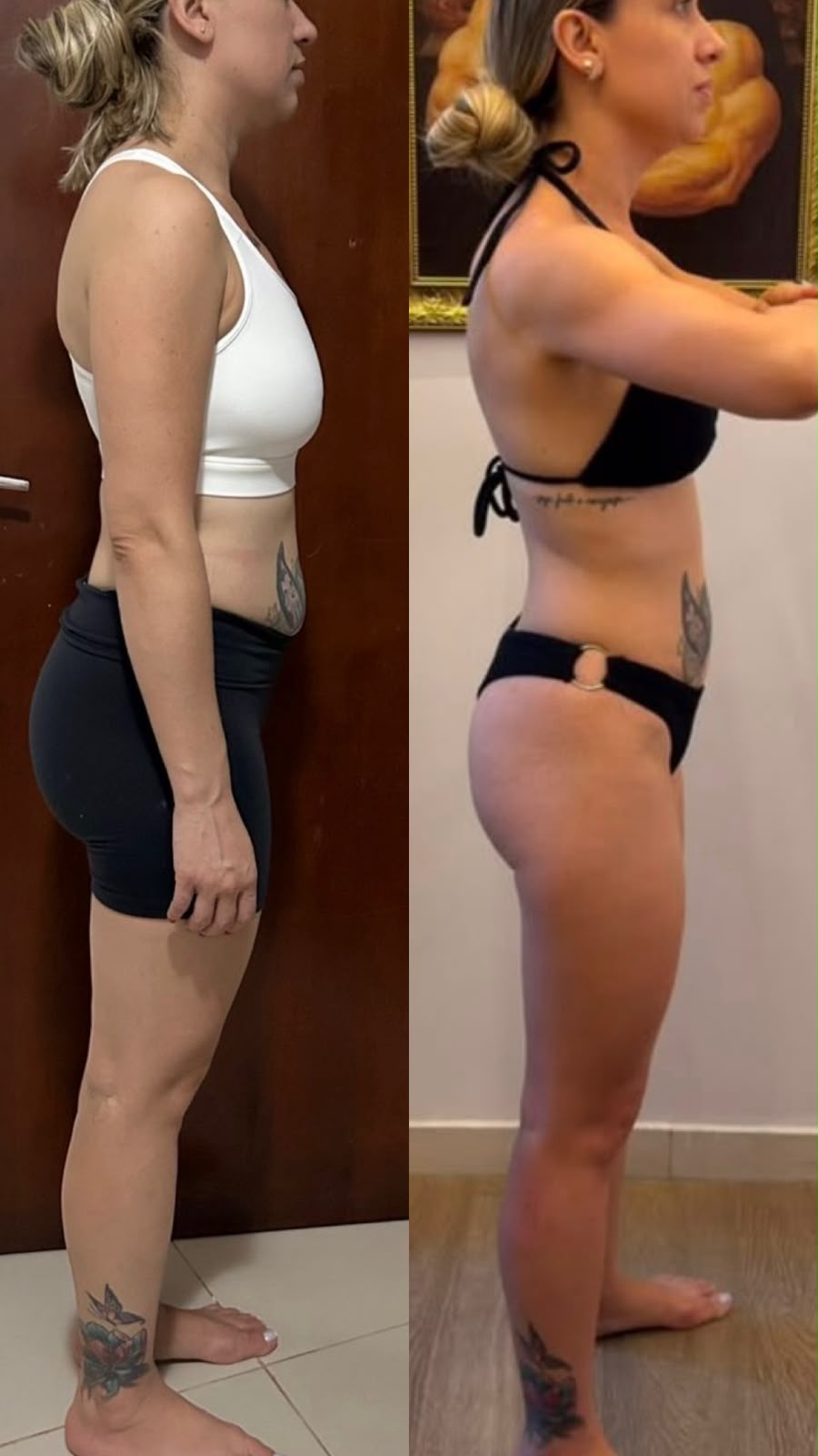 Aline: 4 meses de acompanhamento