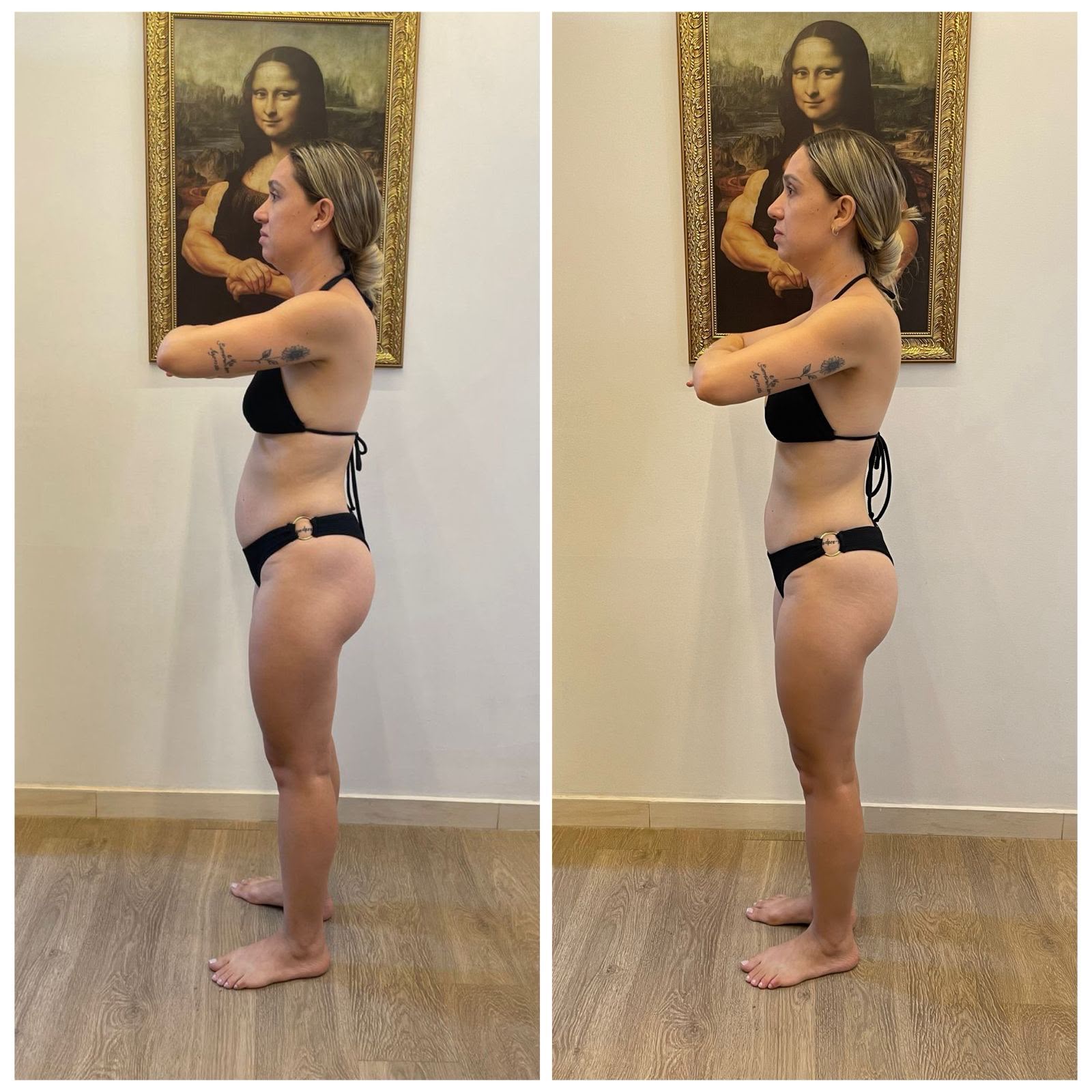 Aline: 4 meses de acompanhamento